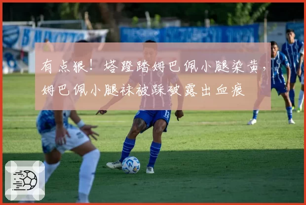 有点狠!塔蹬踏姆巴佩小腿染黄,姆巴佩小腿袜被踩破露出血痕