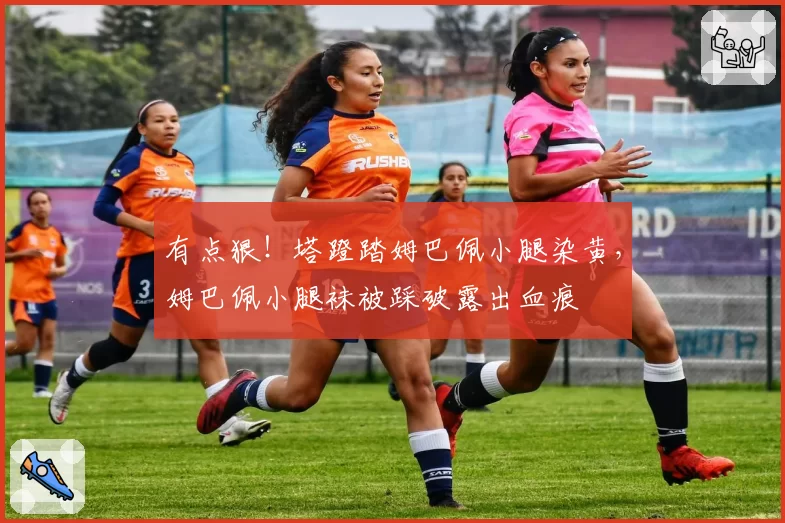 有点狠!塔蹬踏姆巴佩小腿染黄,姆巴佩小腿袜被踩破露出血痕